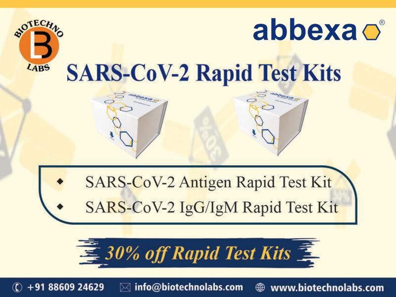 SARS-CoV-2 Rapid Test Kits