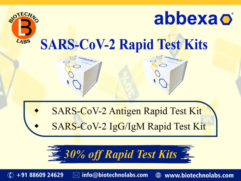 SARS-CoV-2 Rapid Test Kit